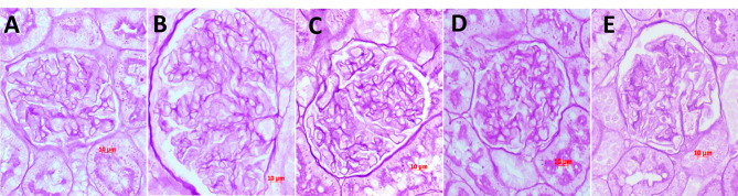 Losartan is more effective than angiotensin (1-7) in preventing thyroxine-induced renal injury in the rat.