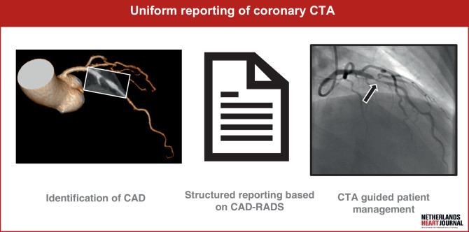 Moving towards a uniform diagnosis of coronary artery disease on coronary CTA : Coronary Artery Disease-Reporting and Data System 2.0.