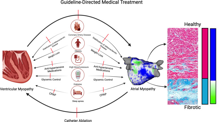 Atrial Fibrillation in Heart Failure: Novel Insights, Challenges, and Treatment Opportunities.