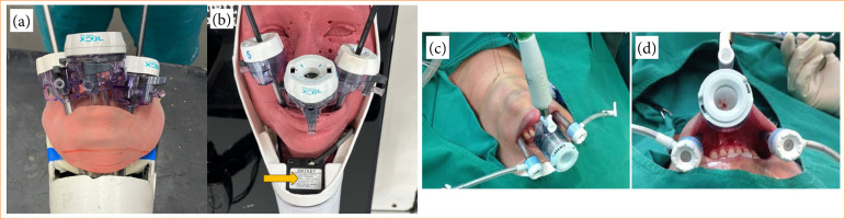 Development and validation of the thyroidectomy training box: cervical simulator for training endoscopic transoral thyroidectomy.