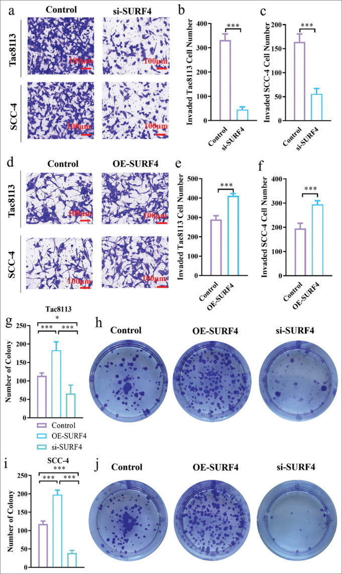 Surfeit 4 regulates aerobic glycolysis to enhanced proliferation, tumor stemness, invasion, and metastasis in oral squamous cell carcinoma.