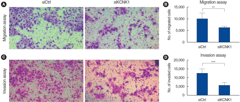 Exploring the Role of the KCNK1 Potassium Channel and Its Inhibition Using Quinidine in Treating Head and Neck Squamous Cell Carcinoma.