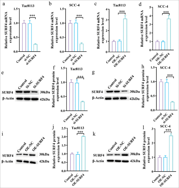 Surfeit 4 regulates aerobic glycolysis to enhanced proliferation, tumor stemness, invasion, and metastasis in oral squamous cell carcinoma.