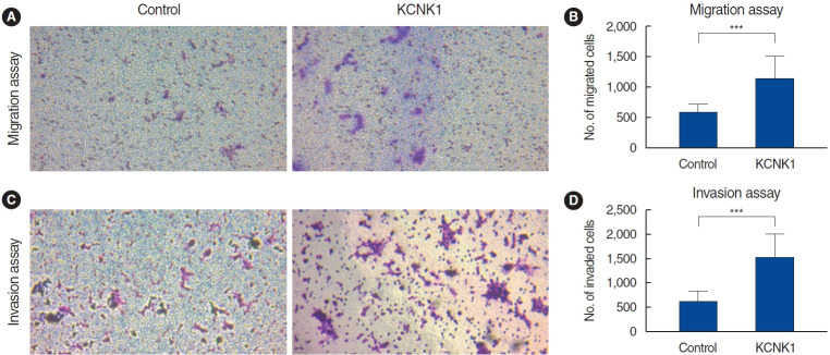 Exploring the Role of the KCNK1 Potassium Channel and Its Inhibition Using Quinidine in Treating Head and Neck Squamous Cell Carcinoma.