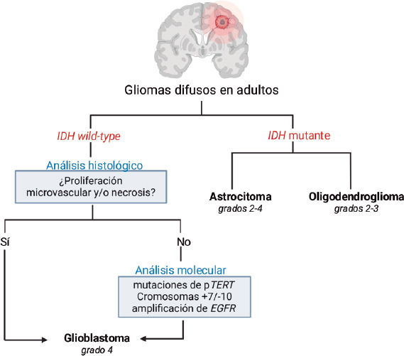 [Glioblastoma and its interaction with neurogenesis].