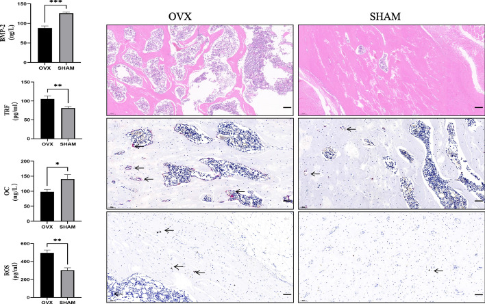 Discovery of potential ferroptosis and osteoporosis biomarkers through TMT proteomics and bioinformatics analysis.