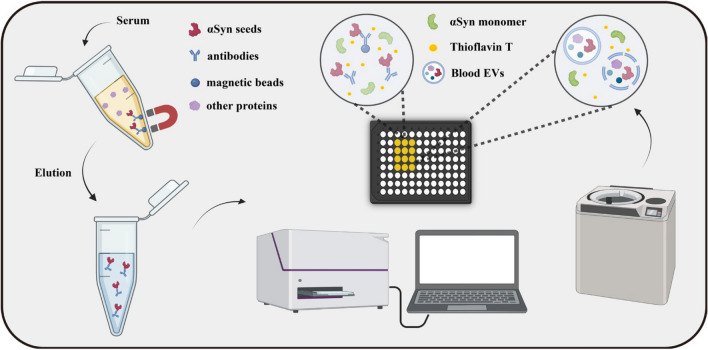 α-Synuclein seeding amplification assays for diagnosing synucleinopathies: an innovative tool in clinical implementation.
