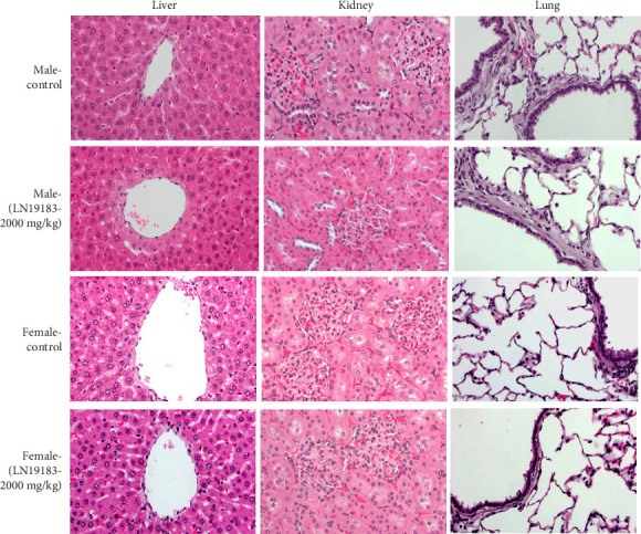 Acute, Subchronic, and Genetic Toxicity Assessments of a Composition of <i>Citrus aurantifolia</i> Fruit Rind and <i>Theobroma cacao</i> Seed Extracts.