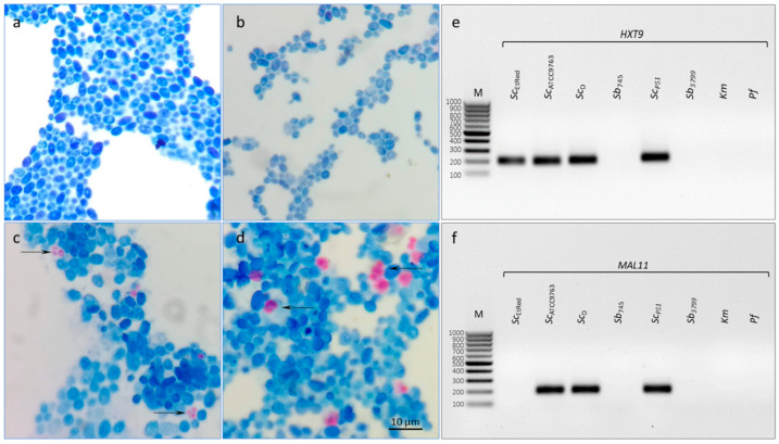 High-Resolution Melting Analysis Potential for <i>Saccharomyces cerevisiae</i> var. <i>boulardii</i> Authentication in Probiotic-Enriched Food Matrices.
