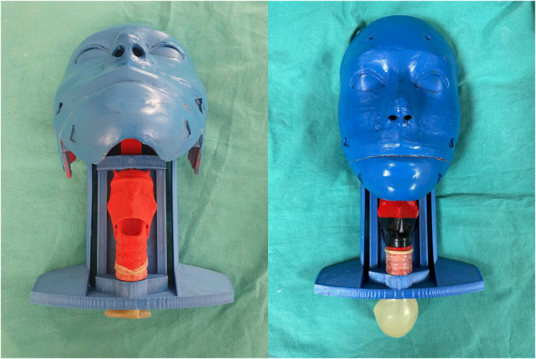 Comparison of bougie-guided cricothyrotomy and traditional cricothyrotomy techniques in an obese 3D-printed surgical airway manikin: a randomized controlled study.