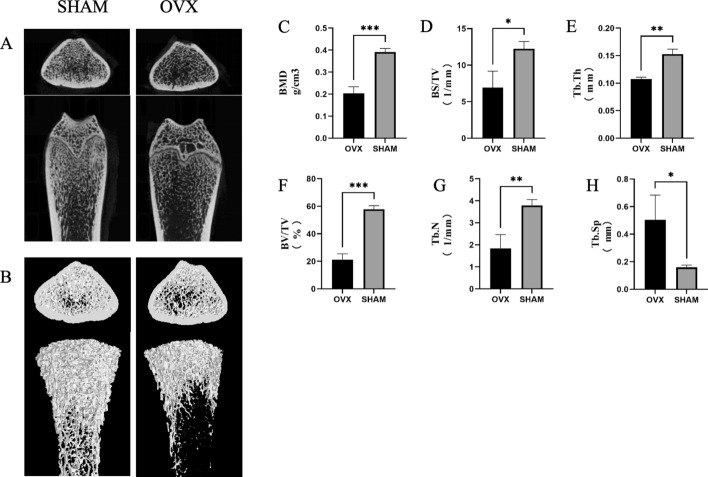 Discovery of potential ferroptosis and osteoporosis biomarkers through TMT proteomics and bioinformatics analysis.