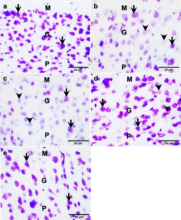 Rauvolfia vomitoria phenol extract relieves pentylenetetrazol-induced seizures in Swiss mice and protects some temporal lobe structures.