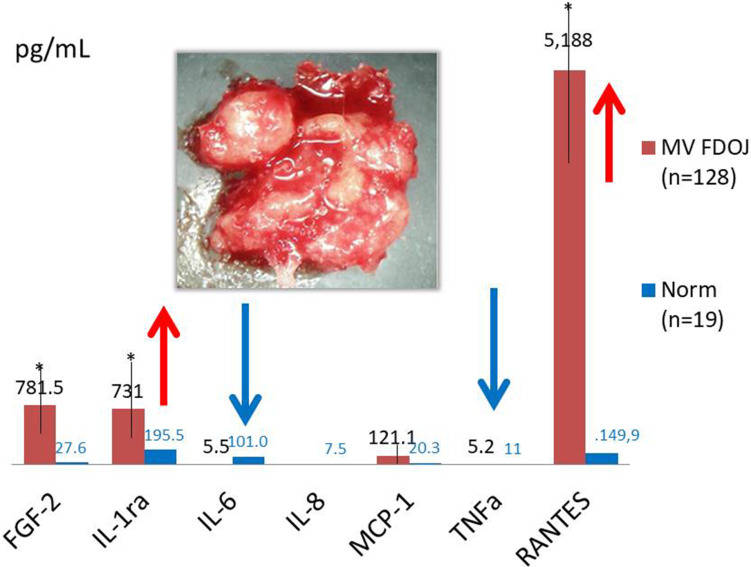 Platelet-Rich Fibrin (PRF) Analyzed for Cytokine Profiles - A Misguided Hope for Osteogenesis in Jawbone Defects? Research and Clinical Observational Study.