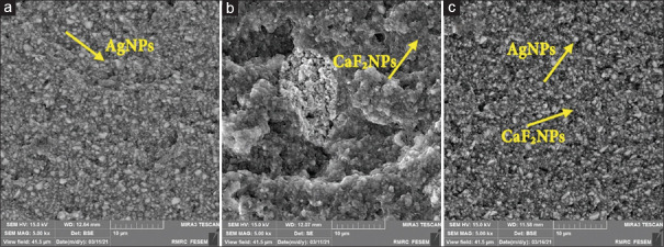 The effect of silver and calcium fluoride nanoparticles on antibacterial activity of composite resin against <i>Streptococcus mutans</i>: An <i>in vitro</i> study.