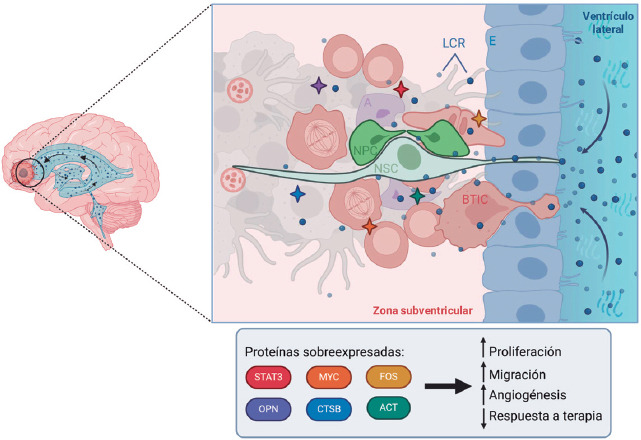 [Glioblastoma and its interaction with neurogenesis].