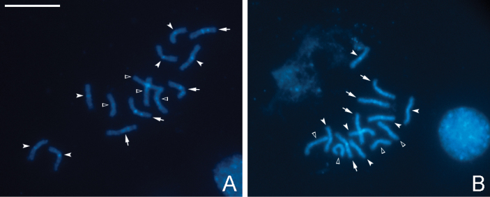 ﻿Chromosomes of <i>Pseudapantelesdignus</i> (Muesebeck, 1938) and a review of known karyotypes of the subfamily Microgastrinae (Hymenoptera, Braconidae).