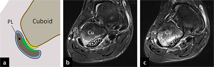 Pivotal role of the synovioentheseal complex in the imaging of arthritis and rheumatic diseases