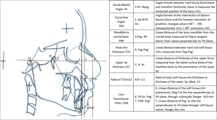 A cross-sectional study to correlate nasal profile and chin position with cephalometric lip profile.