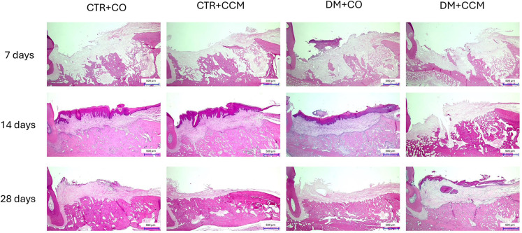 Healing effect of curcumin on tooth extraction sockets in diabetic rats.
