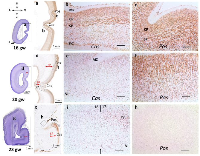 Heterogeneity in the formation of primary and secondary visual fields during human prenatal development.