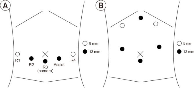 Perioperative outcomes of robot-assisted pancreatoduodenectomy (PD) and totally laparoscopic PD after overcoming learning curves with comparison of oncologic outcomes between open PD and minimally invasive PD.