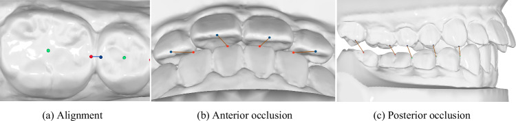 A 3D dental model dataset with pre/post-orthodontic treatment for automatic tooth alignment.