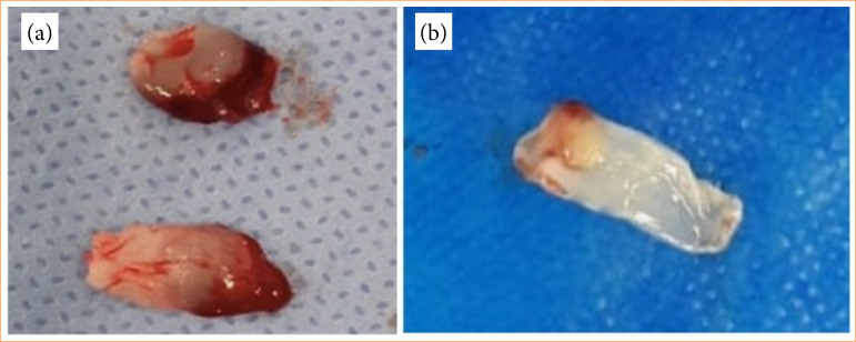 Results of the use of human platelet-rich fibrin membrane applied on colorrhaphy in nourished and malnourished rats.