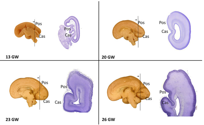 Heterogeneity in the formation of primary and secondary visual fields during human prenatal development.