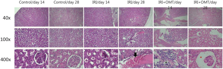 The Use of Autologous Omentum Transposition as a Therapeutic Intervention to Reduce the Complication of Ischemia/Reperfusion Injuries in a Rat Model.