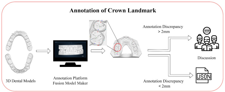 A 3D dental model dataset with pre/post-orthodontic treatment for automatic tooth alignment.