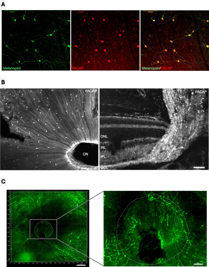 Blue light stimulation of the blind spot in human: from melanopsin to clinically relevant biomarkers of myopia.