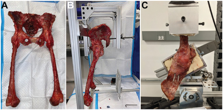 Effect of Acetabular Labral Tear Orientation on Hip Joint Kinematics: A Comparison of Radial Tears, Chondrolabral Junction Tears and Complex Tears in Cadaveric Hips.