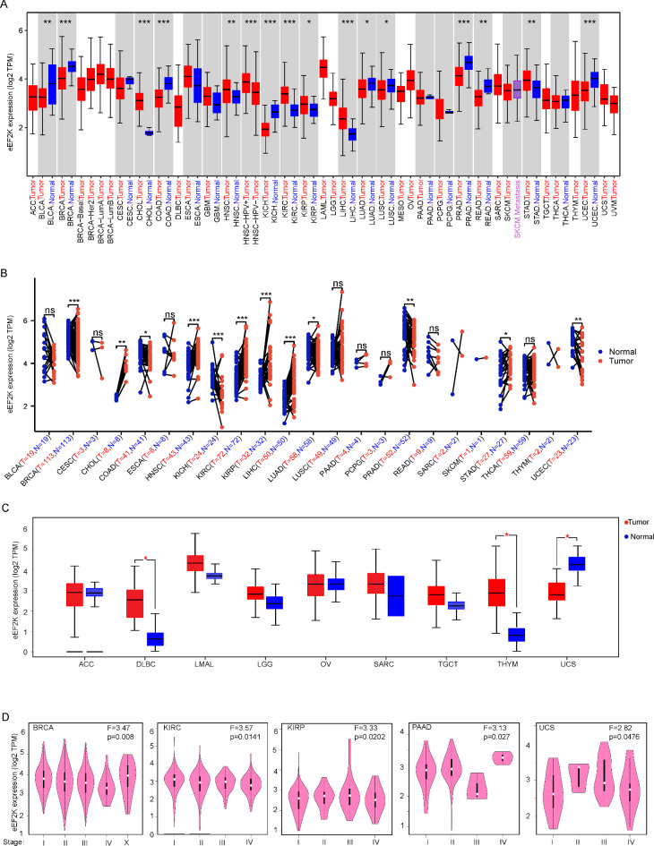 eEF2K as an important kinase associated with cancer survival and prognosis.