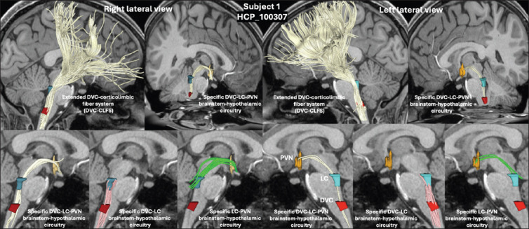 Combined T1-weighted MRI and diffusion MRI tractography of paraventricular, locus coeruleus, and dorsal vagal complex connectivity in brainstem-hypothalamic nuclei.