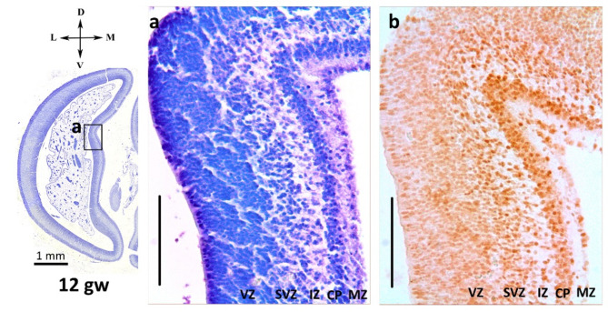 Heterogeneity in the formation of primary and secondary visual fields during human prenatal development.