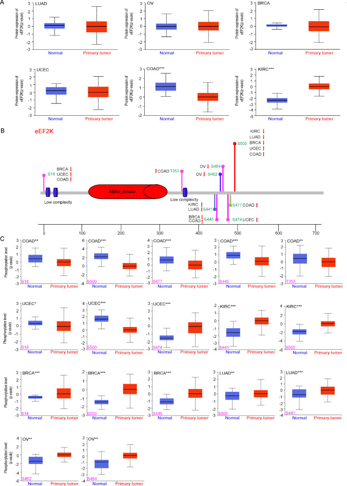 eEF2K as an important kinase associated with cancer survival and prognosis.