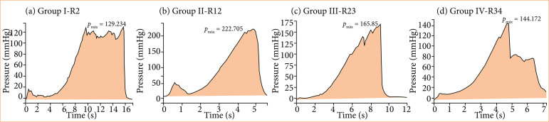 Results of the use of human platelet-rich fibrin membrane applied on colorrhaphy in nourished and malnourished rats.