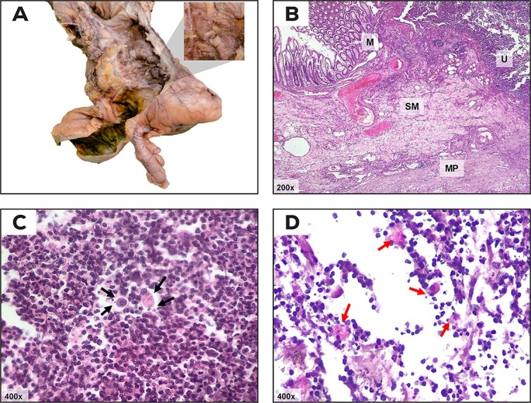 摘要图片