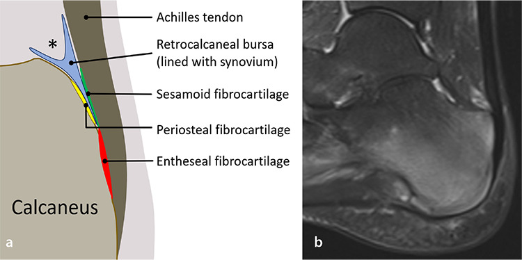 Pivotal role of the synovioentheseal complex in the imaging of arthritis and rheumatic diseases