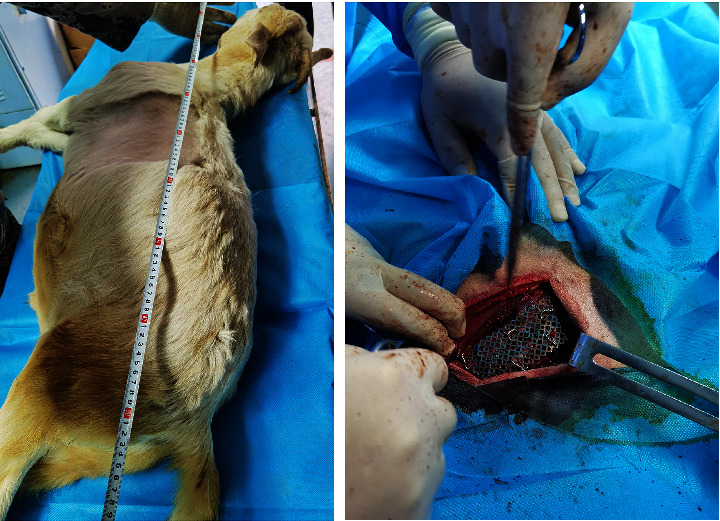 Application of Titanium Mesh in the Early Treatment of Flail Chest.