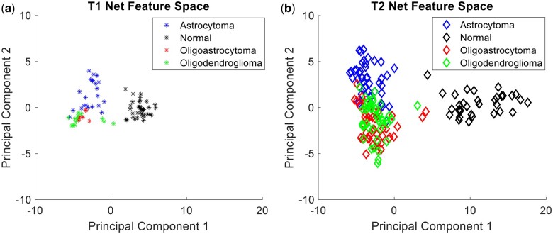 Deep learning and transfer learning for brain tumor detection and classification.