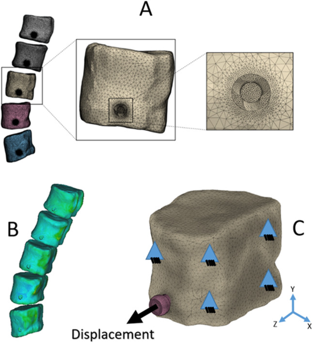 A novel personalized homogenous finite element model to predict the pull-out strength of cancellous bone screws.