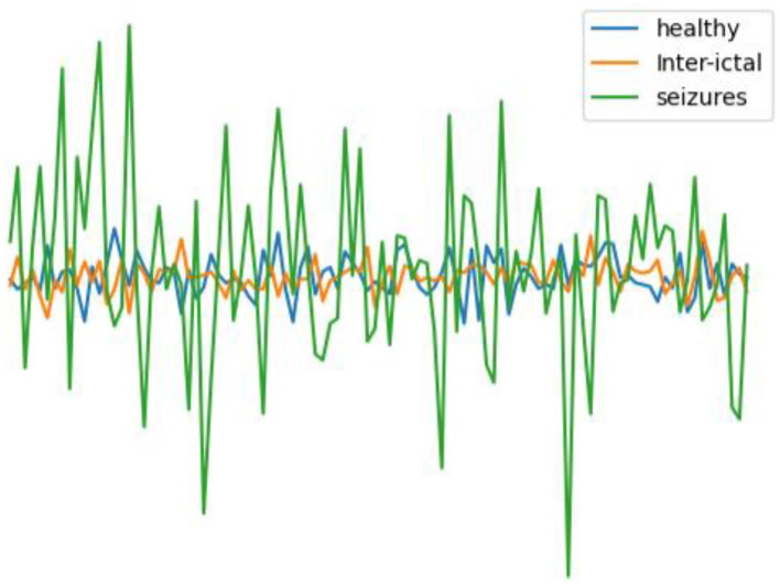 A novel method for optimizing epilepsy detection features through multi-domain feature fusion and selection.