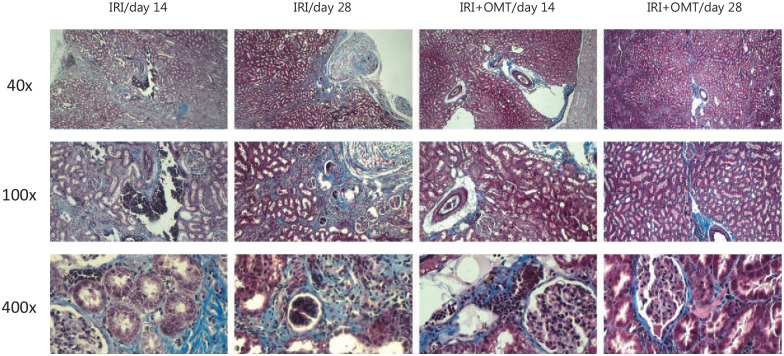 The Use of Autologous Omentum Transposition as a Therapeutic Intervention to Reduce the Complication of Ischemia/Reperfusion Injuries in a Rat Model.