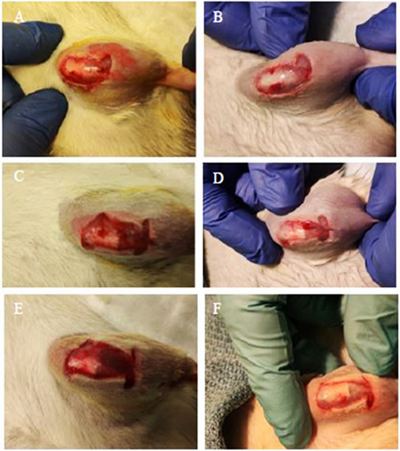 Nanoparticle ultrasonication: a promising approach for reducing bacterial biofilm in total joint infection-an in vivo rat model investigation.