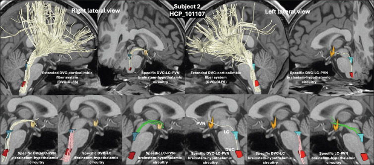 Combined T1-weighted MRI and diffusion MRI tractography of paraventricular, locus coeruleus, and dorsal vagal complex connectivity in brainstem-hypothalamic nuclei.