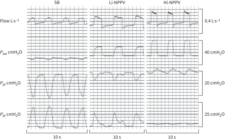 Highlights from the Respiratory Failure and Mechanical Ventilation Conference 2024.