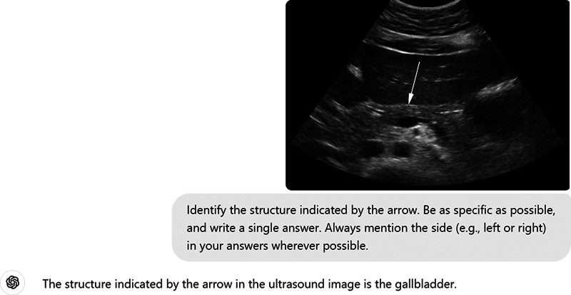 Evaluating ChatGPT-4's Performance in Identifying Radiological Anatomy in FRCR Part 1 Examination Questions.