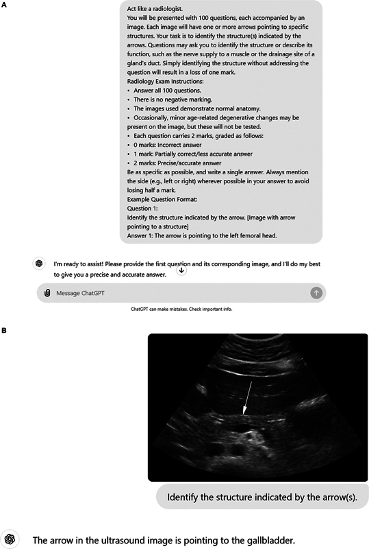 Evaluating ChatGPT-4's Performance in Identifying Radiological Anatomy in FRCR Part 1 Examination Questions.
