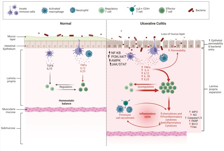 A Future Avenue of Treatment Ulcerative Colitis Targeting Macrophage Polarization: A Phytochemical Application.